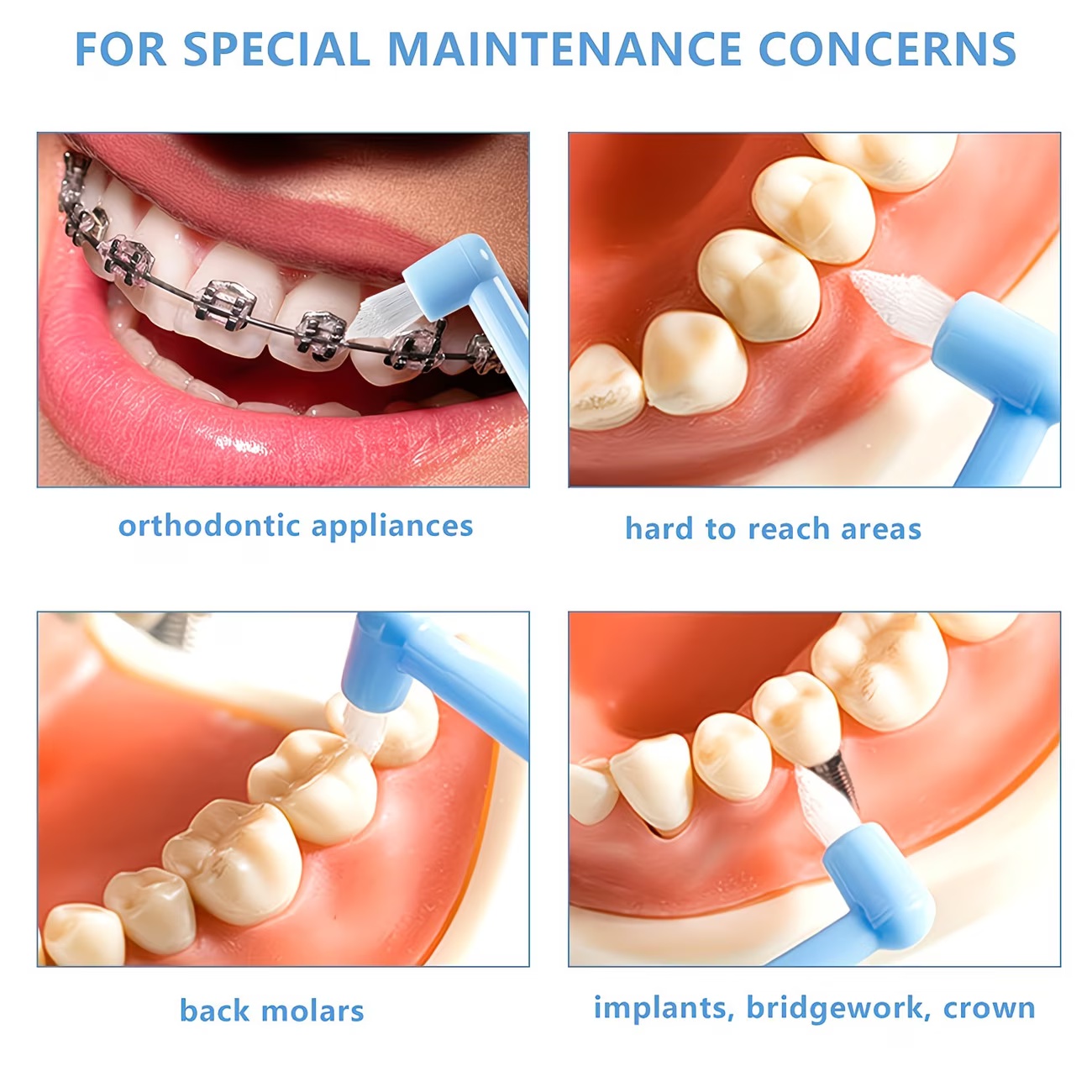 1/3pc Orthodontic Braces Tooth - đánh giá và giá Teeth Whitening With Braces