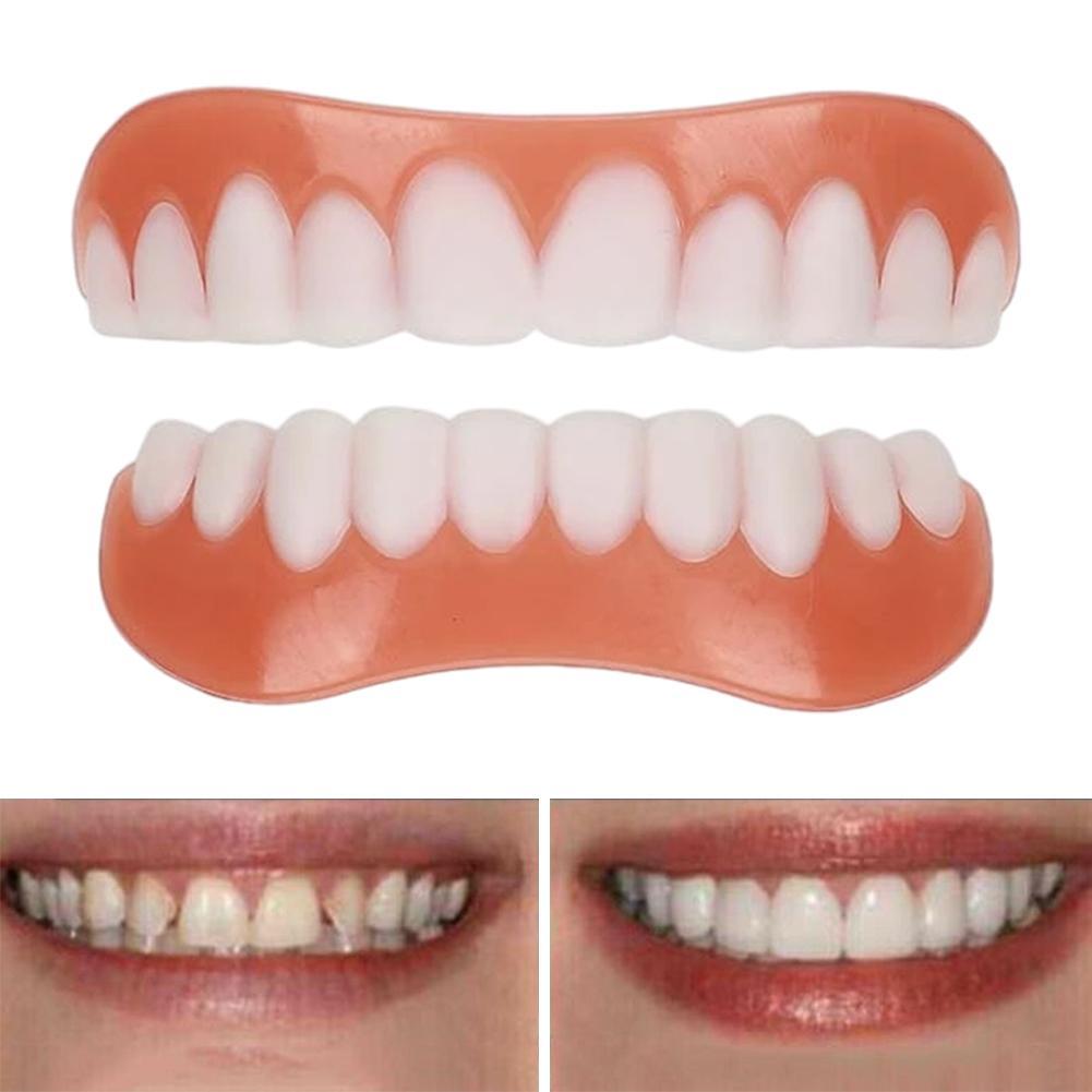 New False Teeth Silicone Upper - đánh giá và giá Teeth Whitening With Braces
