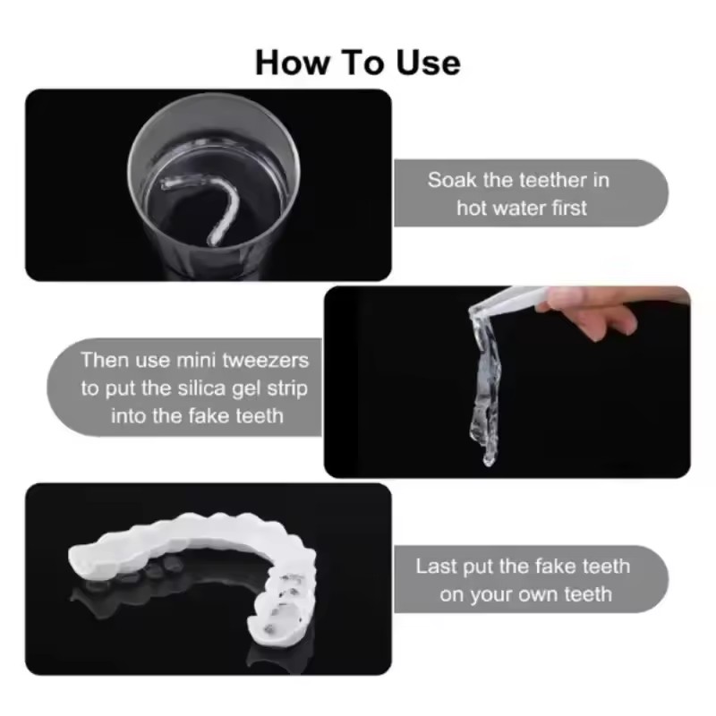Teeth Veneers Whitening Dentur - đánh giá và giá Teeth Whitening With Braces