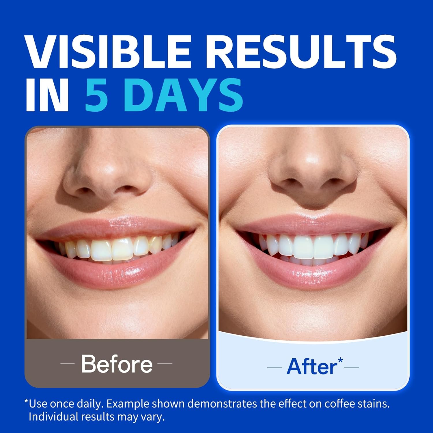 1/7 Pairs Teeth Whitening Stri - đánh giá và giá Teeth Whitening Street