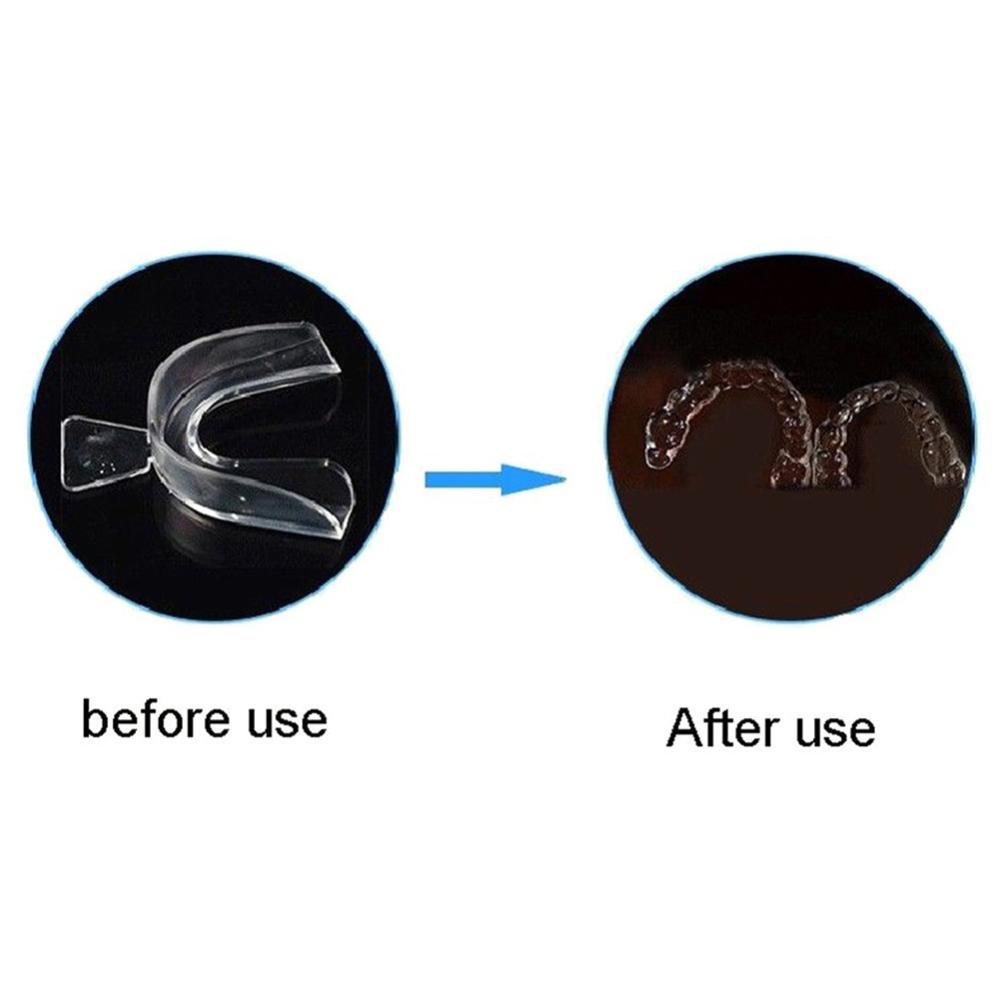 Silicone Mouth Guard Orthodont - đánh giá và giá Teeth Whitening With Braces