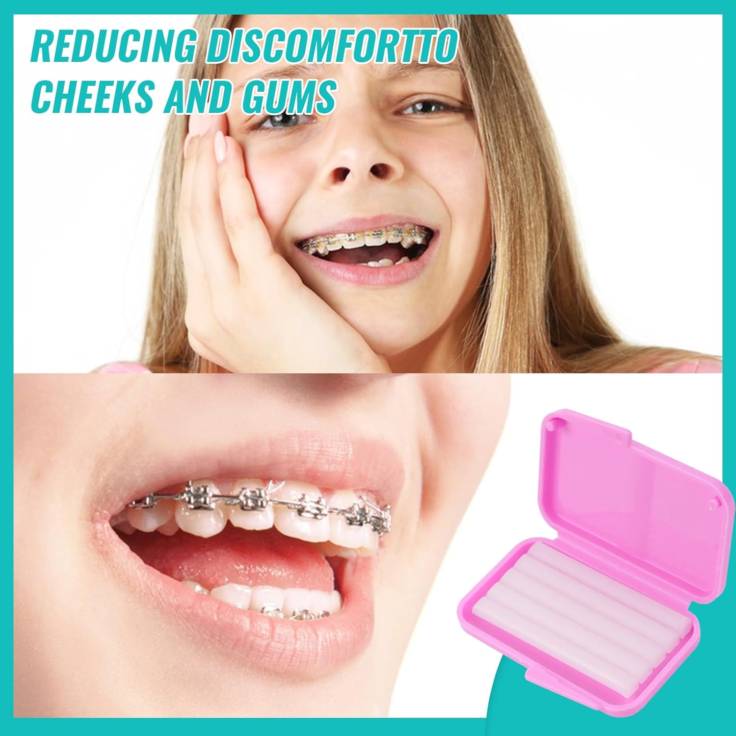 10box Dental Orthodontic Relie - đánh giá và giá Teeth Whitening With Braces