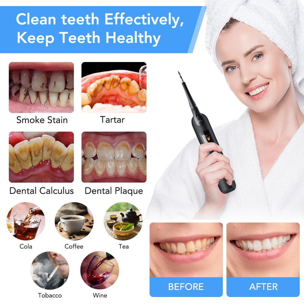 Electric Dental Scaler Toothbr - đánh giá và giá Teeth Whitening Toothbrush